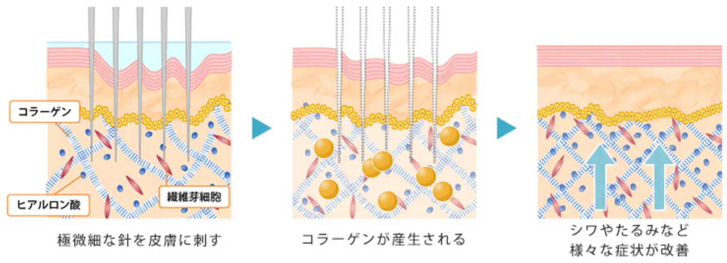 美肌メカニズム