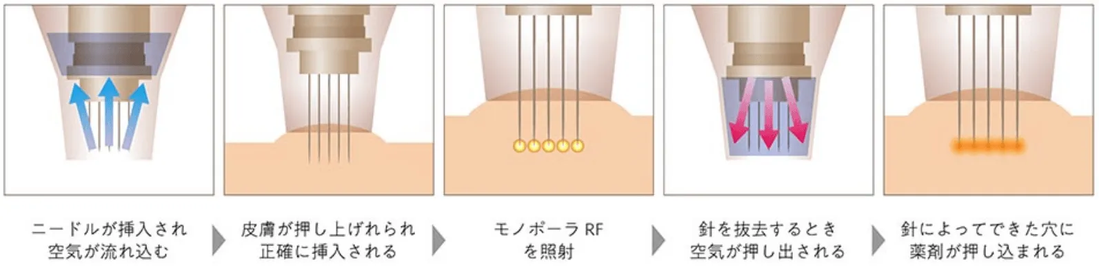 ポテンツぁ