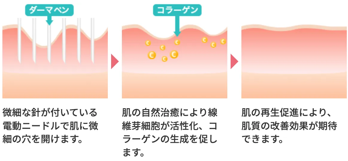 ポテンツぁ