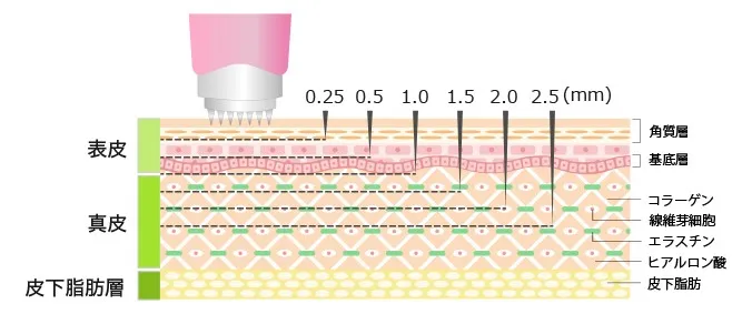 ダーマペン針の深さ