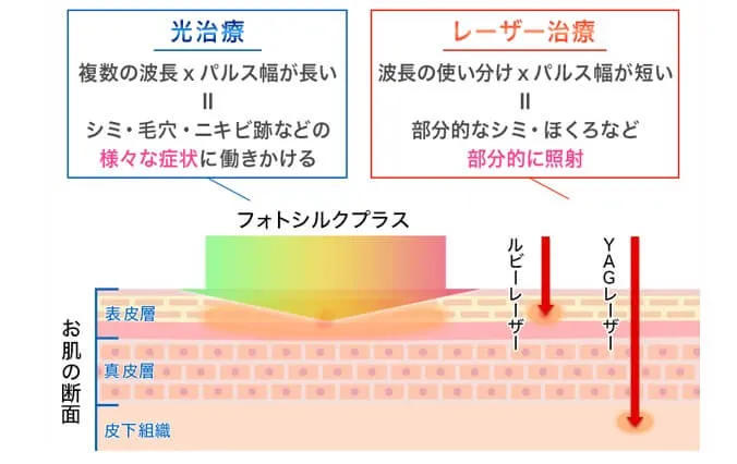 光治療