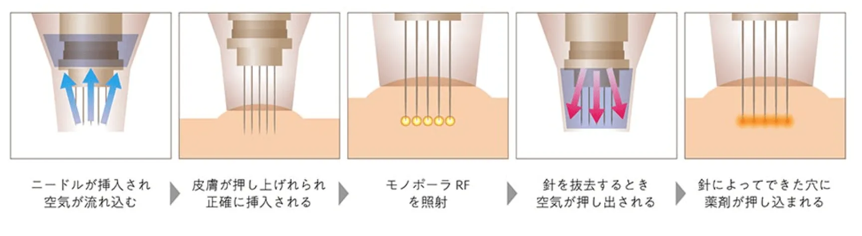 ポテンツァの仕組み