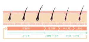 複数回必要な理由はレーザー作用と毛周期にある