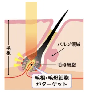 熱破壊式